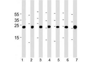 Cebpd antibody western blot analysis in 1) A549, 2) HeLa, 3) NCI-H460, 4) U-937, 5) mouse NIH3T3 cell line, rat 6) lung and 7) testis tissue lysate. (CEBPD antibody  (AA 161-189))