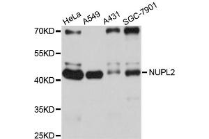 Western blot analysis of extracts of various cell lines, using NUPL2 antibody (ABIN4904603) at 1:1000 dilution.