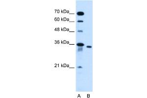 WB Suggested Anti-SLC25A32 Antibody Titration:  0.