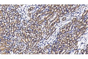 Detection of LY96 in Mouse Kidney Tissue using Polyclonal Antibody to Lymphocyte Antigen 96 (LY96) (LY96 antibody  (AA 19-130))