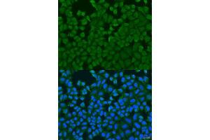 Immunofluorescence analysis of U2OS cells using IL27RA antibody. (IL27 Receptor alpha antibody  (AA 33-283))