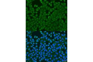 Immunofluorescence analysis of U2OS cells using IL27RA antibody. (IL27 Receptor alpha antibody  (AA 33-283))
