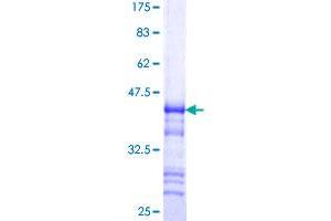Reticulon 2 Protein (RTN2) (AA 1-100) (GST tag)