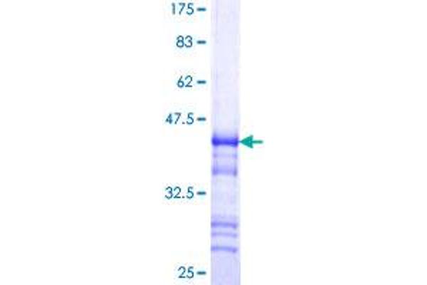 Reticulon 2 Protein (RTN2) (AA 1-100) (GST tag)