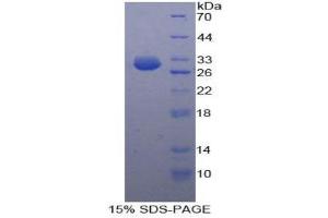 SDS-PAGE (SDS) image for Nucleoporin 160kDa (NUP160) (AA 1211-1436) protein (His tag) (ABIN2126144)