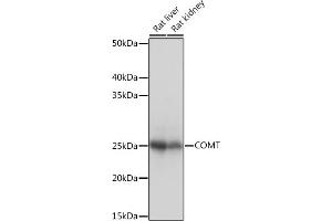 Western blot analysis of extracts of various cell lines, using COMT Rabbit mAb (ABIN1682443, ABIN3018925, ABIN3018926 and ABIN7101689) at 1:1000 dilution. (COMT antibody)