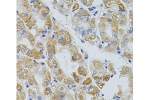 Immunohistochemistry of paraffin-embedded Human stomach using PCSK9 Polyclonal Antibody at dilution of 1:100 (40x lens). (PCSK9 antibody)
