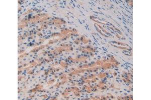 Used in DAB staining on fromalin fixed paraffin- embedded stomach tissue (C8B antibody  (AA 161-503))