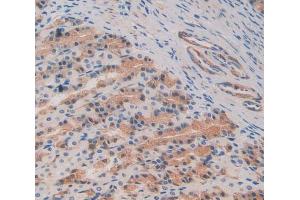 Used in DAB staining on fromalin fixed paraffin- embedded stomach tissue (C8B antibody  (AA 161-503))