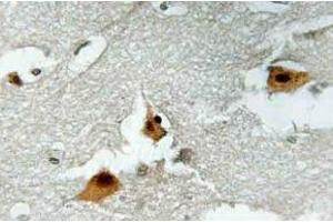 Immunohistochemistry (IHC) analyzes of p-AFX1 in paraffin-embedded human brain tissue. (FOXO4 antibody  (pSer197))