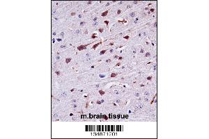 Mouse Ptk2b Antibody immunohistochemistry analysis in formalin fixed and paraffin embedded mouse brain tissue followed by peroxidase conjugation of the secondary antibody and DAB staining. (PTK2B antibody  (AA 672-701))