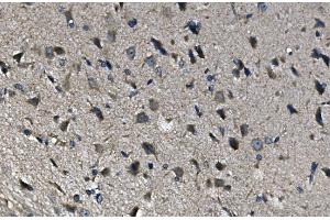 IHC analysis of ADRA1A using anti-ADRA1A antibody (ABIN3043732).