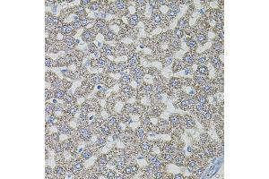 Immunohistochemistry of paraffin-embedded rat liver using MAP3K5 antibody (ABIN1873618) (40x lens). (ASK1 antibody)