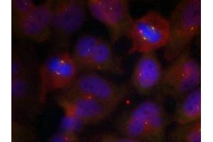 Immunofluorescence staining of methanol-fixed Hela cells using Synaptotagmin 1/2 (Phospho-Thr202/199) Antibody. (SYT1/SYT2 (pThr199), (pThr202) antibody)