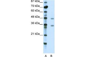 WB Suggested Anti-CBX8 Antibody Titration:  2.