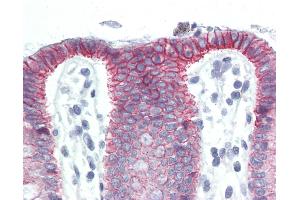 Anti-CTNNB1 / Beta Catenin antibody IHC of human colon. (CTNNB1 antibody  (C-Term))