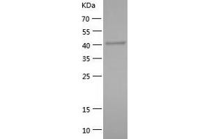 Western Blotting (WB) image for DnaJ (Hsp40) Homolog, Subfamily A, Member 1 (DNAJA1) (AA 1-394) protein (His tag) (ABIN7285948) (DNAJA1 Protein (AA 1-394) (His tag))