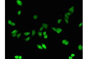 Immunofluorescent analysis of HepG2 cells using ABIN7159517 at dilution of 1:100