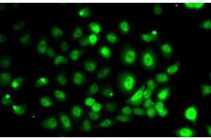 Immunofluorescence analysis of MCF7 cells using PPP2R1B Polyclonal Antibody (PPP2R1B antibody)