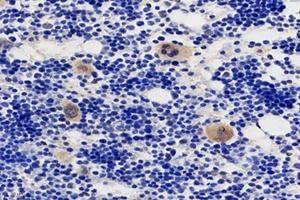 Immunohistochemistry analysis of paraffin-embedded rat bone using,TMEM177 (ABIN7075996) at dilution of 1: 1000 (TMEM177 antibody)