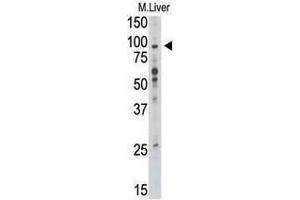 Image no. 1 for anti-Toll-Like Receptor 6 (TLR6) (C-Term) antibody (ABIN357053) (TLR6 antibody  (C-Term))