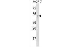 Western blot analysis in MCF-7 cell line lysates (35ug/lane) using Ladinin-1  Antibody (N-term).