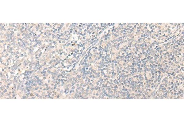 Radil antibody