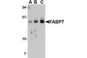 Western blot analysis of FABP7 in human breast tissue lysate with AP30326PU-N FABP7 antibody at (A) 0. (FABP7 antibody  (Center))