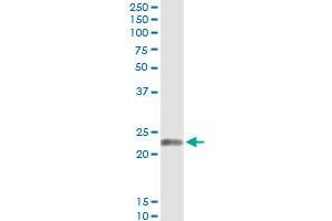 Immunoprecipitation of EDN1 transfected lysate using anti-EDN1 monoclonal antibody and Protein A Magnetic Bead , and immunoblotted with EDN1 MaxPab rabbit polyclonal antibody. (Endothelin 1 antibody  (AA 113-212))