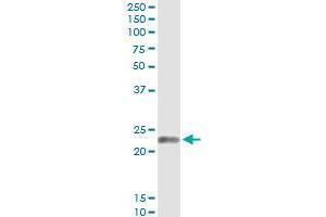 Immunoprecipitation of EDN1 transfected lysate using anti-EDN1 monoclonal antibody and Protein A Magnetic Bead , and immunoblotted with EDN1 MaxPab rabbit polyclonal antibody.