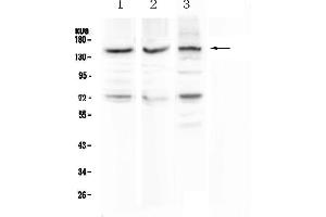 Western blot analysis of CD163 using anti-CD163 antibody . (CD163 antibody  (AA 47-201))