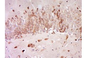 Paraformaldehyde-fixed, paraffin embedded rat brain, Antigen retrieval by boiling in sodium citrate buffer (pH6) for 15min, Block endogenous peroxidase by 3% hydrogen peroxide for 30 minutes, Blocking buffer (normal goat serum) at 37°C for 20min, Antibody incubation with Rabbit Anti-AGXT2L2 Polyclonal Antibody, Unconjugated  at 1:500 overnight at 4°C, followed by a conjugated secondary for 90 minutes and DAB staining. (AGXT2L2 antibody)