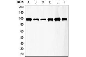 Western blot analysis of FGFR3 expression in HeLa (A), A549 (B), T47D (C), mouse kidney (D), mouse heart (E), rat lung (F) whole cell lysates.