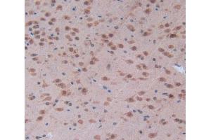 Used in DAB staining on fromalin fixed paraffin- embedded brain tissue (CD28 antibody  (AA 33-174))