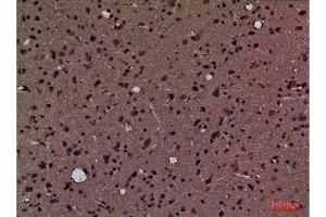 Immunohistochemistry (IHC) image for anti-Peptidylprolyl Isomerase A (Cyclophilin A) (PPIA) (Internal Region) antibody (ABIN6284334)
