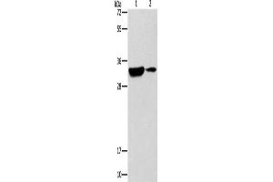 Western Blotting (WB) image for anti-Regulator of Calcineurin 1 (RCAN1) antibody (ABIN2432541) (RCAN1 antibody)
