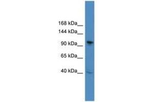 Image no. 1 for anti-B-Cell CLL/lymphoma 11B (Zinc Finger Protein) (BCL11B) (C-Term) antibody (ABIN6745310)