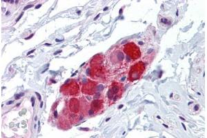 Human Small Intestine, submucosal plexus: Formalin-Fixed, Paraffin-Embedded (FFPE) (TRPV2 antibody  (AA 595-764))