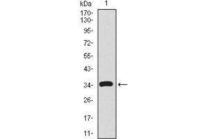 Western blot analysis using CD59 antibody against human CD59 recombinant protein. (CD59 antibody  (AA 31-111))