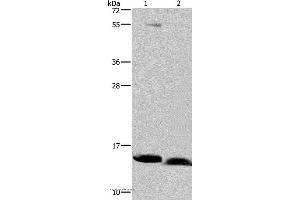 Western blot analysis of Human bladder carcinoma and fetal brain tissue, using NDUFA5 Polyclonal Antibody at dilution of 1:400