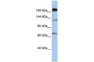 MTR antibody used at 1 ug/ml to detect target protein. (MTR antibody  (C-Term))