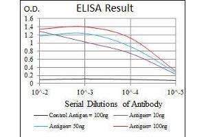 Black line: Control Antigen (100 ng), Purple line: Antigen(10 ng), Blue line: Antigen (50 ng), Red line: Antigen (100 ng), (LC3B antibody)