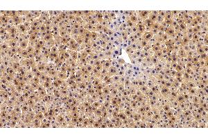 Detection of ASS1 in Rat Liver Tissue using Polyclonal Antibody to Argininosuccinate Synthetase 1 (ASS1)