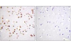 Immunohistochemistry analysis of paraffin-embedded human brain tissue, using Catenin-delta1 (Ab-228) Antibody.