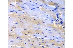 Immunohistochemistry of paraffin-embedded Mouse heart using CUL2 Polyclonal Antibody at dilution of 1:200 (40x lens). (Cullin 2 antibody)