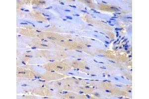 Immunohistochemistry of paraffin-embedded Mouse heart using CUL2 Polyclonal Antibody at dilution of 1:200 (40x lens).