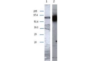 Western Blot analysis using TGM1 antibody Cat. (TGM1 antibody)