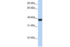 ASB5 antibody used at 1 ug/ml to detect target protein. (ASB5 antibody  (C-Term))