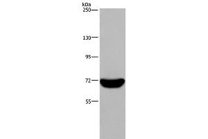 Western Blot analysis of Raji cell using LCP1 Polyclonal Antibody at dilution of 1:300 (LCP1 antibody)