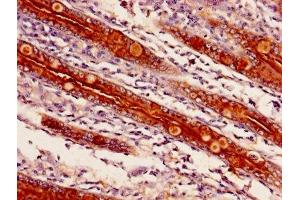 Immunohistochemistry of paraffin-embedded human small intestine tissue using ABIN7143250 at dilution of 1:100 (APEH antibody  (AA 201-500))